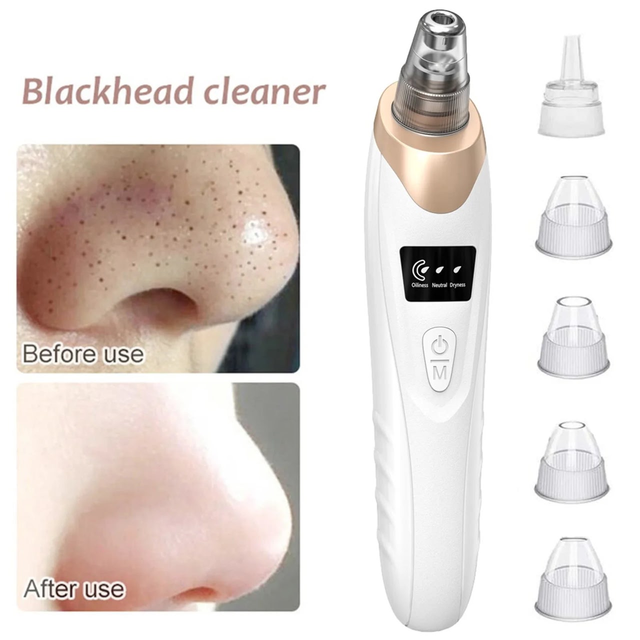 Blackhead and whitehead remover device